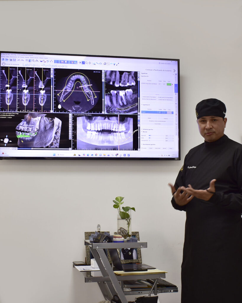 Dental Implants in Tijuana