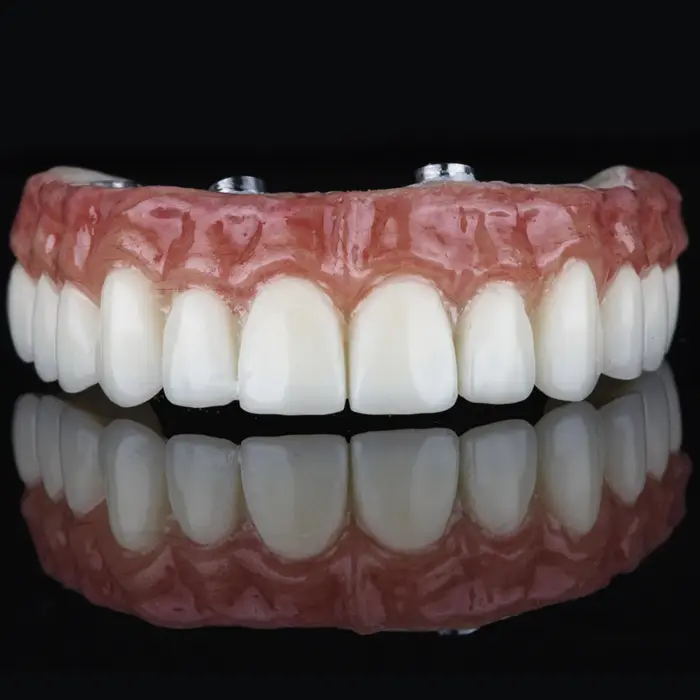 All on 4 dental implants in tijuana mexico